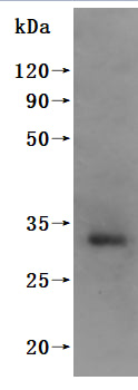 this product is detected by Mouse anti-6*His monoclonal antibody.Recombinant Human Kita-Kyushu Lung Cancer Antigen 1 (CT83) Protein (His)