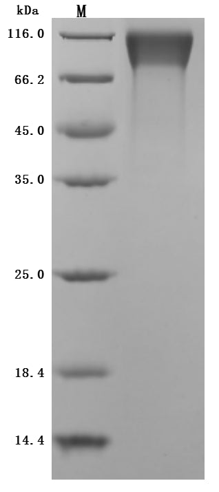 Greater than 95% as determined by SDS-PAGE.Recombinant Mouse Tyrosine-Protein Kinase Mer (MERTK) Protein (His), Active