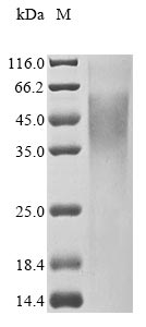 Greater than 85% as determined by SDS-PAGE.Recombinant Mouse Tripeptidyl-Peptidase 2 (TPP2) Protein (His&Myc)