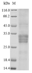 Greater than 85% as determined by SDS-PAGE.Recombinant Rat Oncostatin-M (OSM) Protein (His)