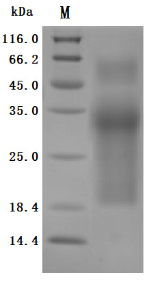 Greater than 95% as determined by SDS-PAGE.Recombinant Human Mucin-17 (MUC17) Protein (His), Active