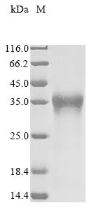 Greater than 90% as determined by SDS-PAGE.Recombinant Pongo Abelii Lysosome-Associated Membrane Glycoprotein 5 (LAMP5) Protein (His&Myc)