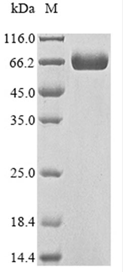 Greater than 90% as determined by SDS-PAGE.Recombinant Human Cd276 Antigen (CD276) Protein (Fc-Myc), Active