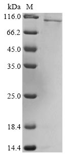 Greater than 85% as determined by SDS-PAGE.Recombinant Human Olfactomedin-Like Protein 2B (OLFML2B) Protein (His&Myc)