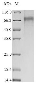 Greater than 85% as determined by SDS-PAGE.Recombinant Mouse Extracellular Tyrosine-Protein Kinase Pkdcc (PKDCC) Protein (His&Myc)