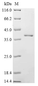 Greater than 90% as determined by SDS-PAGE.Recombinant Human Anoctamin-5 (ANO5) Protein (His)
