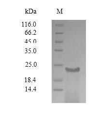Greater than 90% as determined by SDS-PAGE.Recombinant Sudan Ebolavirus Envelope Glycoprotein (GP) Protein (His)