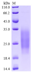 Greater than 95% as determined by SDS-PAGE.Recombinant Human Single Ig Il-1-Related Receptor (SIGIRR) Protein (His)
