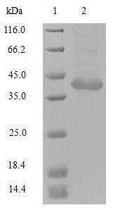 Greater than 90% as determined by SDS-PAGE.Recombinant Human Tripartite Motif-Containing Protein 72 (TRIM72) Protein (Flag-Myc)