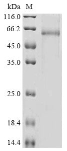 Greater than 85% as determined by SDS-PAGE.Recombinant Mouse A Disintegrin And Metalloproteinase With Thrombospondin Motifs 13 (ADAMTS13) Protein (hFc)