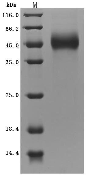 Greater than 95% as determined by SDS-PAGE.Recombinant Mouse Gdnf Family Receptor Alpha-Like (GFRAL) Protein (His&Myc), Active