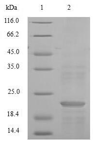 Greater than 90% as determined by SDS-PAGE.Recombinant Mouse Normal Mucosa Of Esophagus-Specific Gene 1 Protein (NMES1) Protein (Flag-Myc)