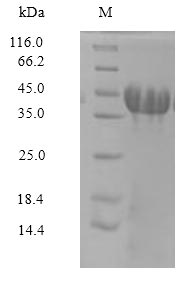 Greater than 90% as determined by SDS-PAGE.Recombinant Rat Amphoterin-Induced Protein 3 (AMIGO3) Protein (His-Myc)