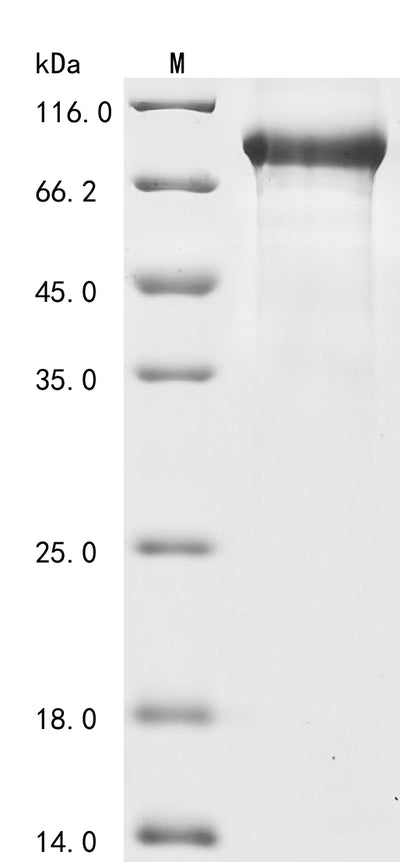 Greater than 85% as determined by SDS-PAGE.Recombinant Mouse Complement C1S-1 Subcomponent (C1S1) Protein (His)