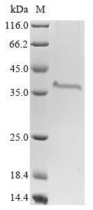 Greater than 85% as determined by SDS-PAGE.Recombinant Bovine Coronavirus Spike Glycoprotein (S) Protein (His)