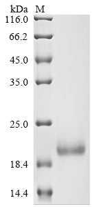 Greater than 90% as determined by SDS-PAGE.Recombinant Human Secreted And Transmembrane Protein 1 (SECTM1) Protein (His)