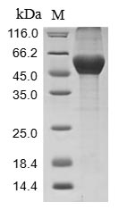 Greater than 85% as determined by SDS-PAGE.Recombinant Mouse Serine Protease Inhibitor A3N (SERPINA3N) Protein (His)