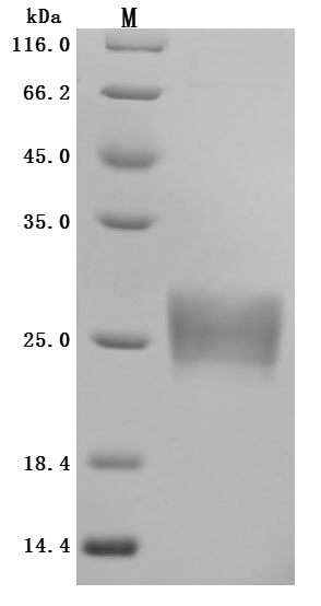 Greater than 95% as determined by SDS-PAGE.Recombinant Human Zymogen Granule Protein 16 Homolog B (ZG16B) Protein (His), Active