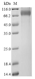 Greater than 90% as determined by SDS-PAGE.Recombinant Human X-Linked Retinitis Pigmentosa Gtpase Regulator (RPGR) Protein (hFc)