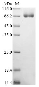 Greater than 90% as determined by SDS-PAGE.Recombinant Mouse Chitinase-Like Protein 4 (CHIL4) Protein (hFc)