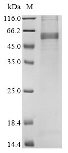 Greater than 85% as determined by SDS-PAGE.Recombinant Avian Infectious Bronchitis Virus Nucleoprotein (N) Protein (His)