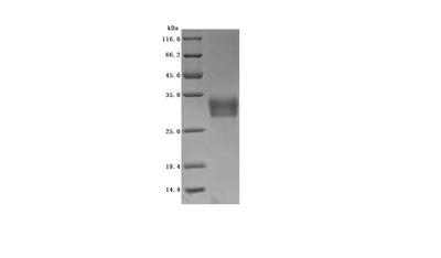 Greater than 95% as determined by SDS-PAGE.Recombinant Human C-Type Lectin Domain Family 4 Member C (CLEC4C) Protein (His-Myc), Active