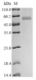 Greater than 85% as determined by SDS-PAGE.Recombinant Avian Infectious Bronchitis Virus Nucleoprotein (N) Protein (His)