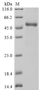 Greater than 90% as determined by SDS-PAGE.Recombinant Rat Interleukin-11 (IL11) Protein (hFc)