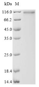 Greater than 85% as determined by SDS-PAGE.Recombinant Human Amyloid-Beta A4 Precursor Protein-Binding Family A Member 2 (APBA2) Protein (His&Myc)