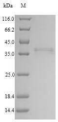 Greater than 90% as determined by SDS-PAGE.Recombinant Human Collectin-11 (COLEC11) Protein (His&Myc)