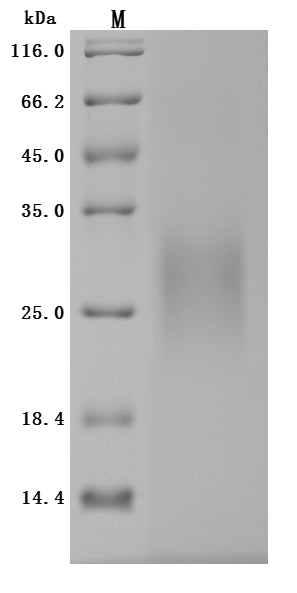 Greater than 95% as determined by SDS-PAGE.Recombinant Human Igf-Like Family Receptor 1 (IGFLR1) Protein (His), Active