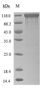 Greater than 90% as determined by SDS-PAGE.Recombinant Human Angiotensin-Converting Enzyme 2 (ACE2) Protein (hFc), Active