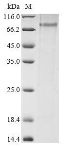 Greater than 85% as determined by SDS-PAGE.Recombinant Rat Mannan-Binding Lectin Serine Protease 2 (MASP2) Protein (His)