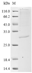 Greater than 85% as determined by SDS-PAGE.Recombinant Human Comm Domain-Containing Protein 5 (COMMD5) Protein (His&Myc)