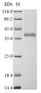 Greater than 85% as determined by SDS-PAGE.