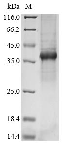 Greater than 85% as determined by SDS-PAGE.