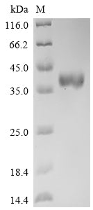 Greater than 95% as determined by SDS-PAGE.Recombinant Human Delta-Like Protein 3 (DLL3) Protein (mFc)