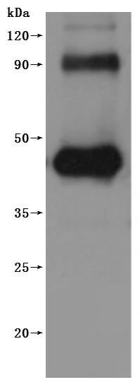 this product is detected by Mouse anti-6*His monoclonal antibody.Recombinant Human G-Protein Coupled Receptor Family C Group 5 Member D (GPRC5D) Protein (His), Active