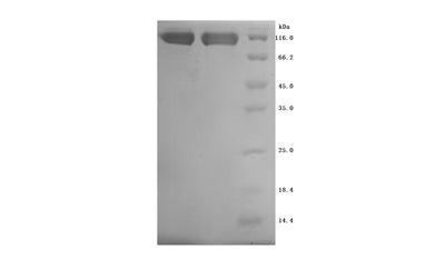 Greater than 95% as determined by SDS-PAGE.Recombinant Human Cub Domain-Containing Protein 1 (CDCP1) Protein (His), Active