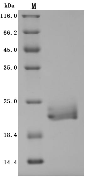 Greater than 95% as determined by SDS-PAGE.Recombinant Human E3 Ubiquitin-Protein Ligase Znrf3 (ZNRF3) Protein (His), Active