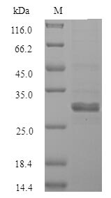 Greater than 90% as determined by SDS-PAGE.Recombinant Human Sal-Like Protein 2 (SALL2) Protein (Flag-Myc)