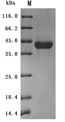 Greater than 95% as determined by SDS-PAGE.Recombinant Human V-Set And Immunoglobulin Domain-Containing Protein 4 (VSIG4) Protein (His), Active
