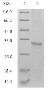 Greater than 90% as determined by SDS-PAGE.Recombinant Human Testisin (PRSS21) Protein (His&Myc)