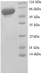 Greater than 90% as determined by SDS-PAGE.Recombinant Human Glyceraldehyde-3-Phosphate Dehydrogenase (GAPDH) Protein (GST)