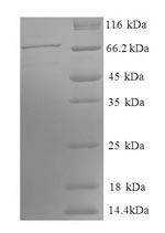 Greater than 90% as determined by SDS-PAGE.Recombinant Human Phosphoglycerate Kinase 1 (PGK1) Protein (GST)