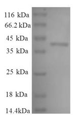 Greater than 90% as determined by SDS-PAGE.Recombinant Human L-Lactate Dehydrogenase A Chain (LDHA) Protein (His)
