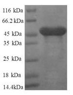 Greater than 90% as determined by SDS-PAGE.Recombinant Human 60S Ribosomal Protein L11 (RPL11) Protein (GST)