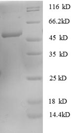 Greater than 90% as determined by SDS-PAGE.Recombinant Human Rho Gdp-Dissociation Inhibitor 1 (ARHGDIA) Protein (GST)
