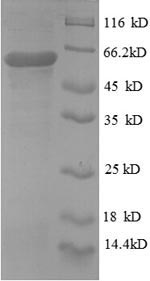 Greater than 90% as determined by SDS-PAGE.Recombinant Human Protein Disulfide-Isomerase (P4HB) Protein (GST)