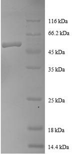 Greater than 90% as determined by SDS-PAGE.Recombinant Human Ras-Related Protein Rab-1A (RAB1A) Protein (GST)